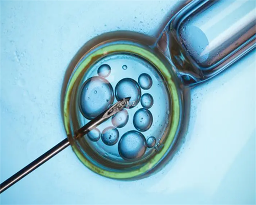 成都供卵的优缺点&无忧试管包成功,成都生殖妇幼医院用精子库供精做人工授精费用多少？