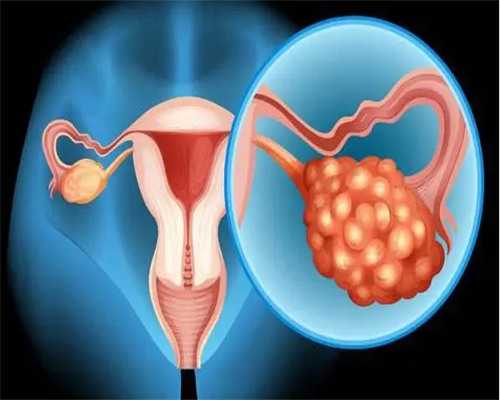 成都市妇女儿童中心医院做供精人工授精费用是多少？